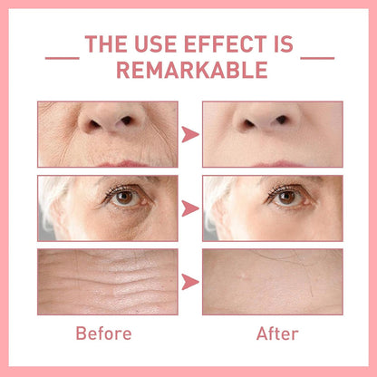 🥰PDRN Pink Peptide Serum